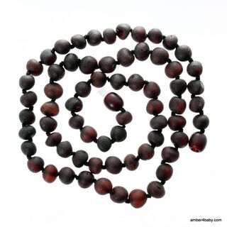 Cherry Baroque Baltic Amber Necklace for Adults