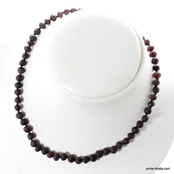 Cherry Baroque Baltic Amber Necklace for Adults